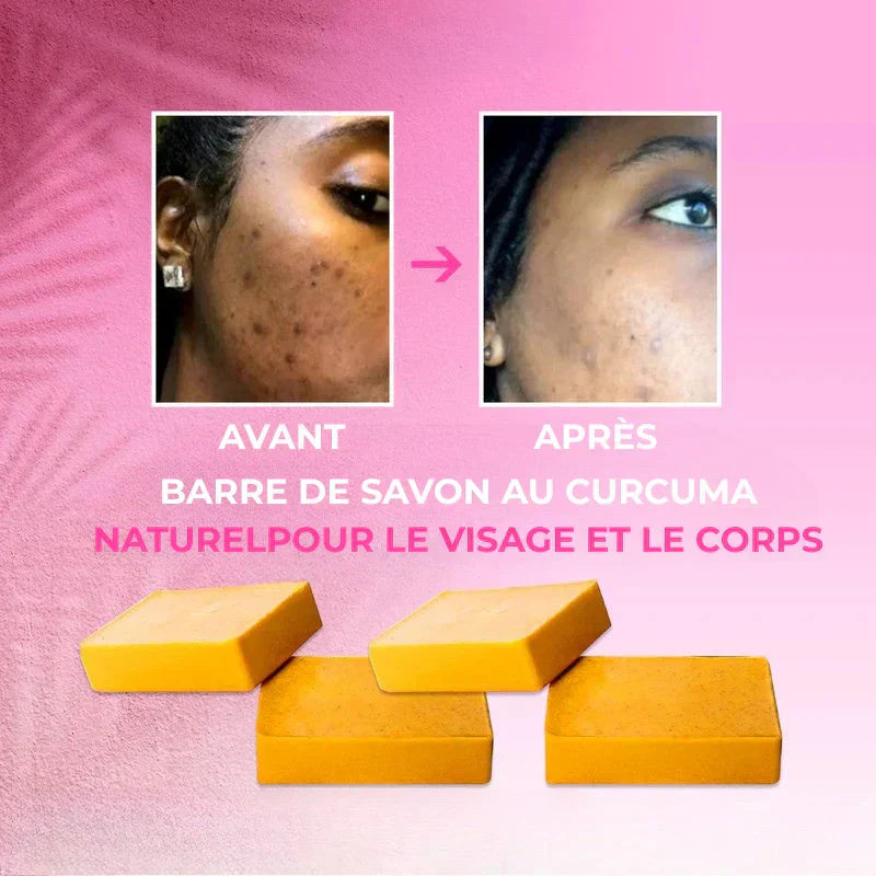 Unifie le teint : Savon Éclaircissant pour un teint lumineux et uniforme